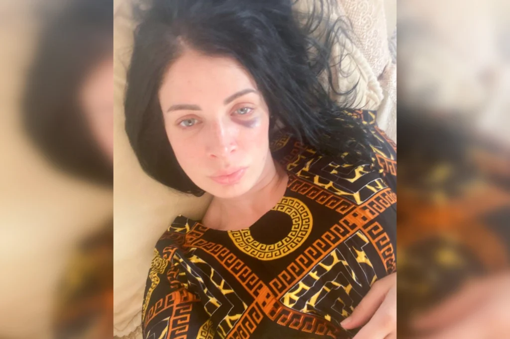 Селфи Марии Смелой, которое она отправила координаторке правозащитного проекта «Кавказ без матери» Лидии Михальченко.