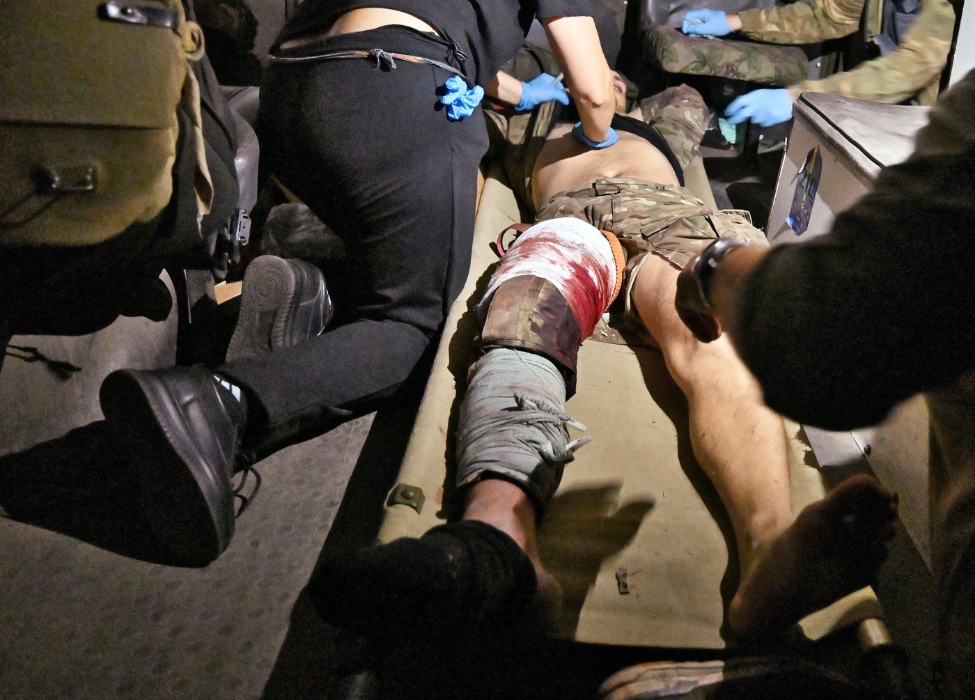 Новые правила выплат за ранений на “СВО”: военные возмущены