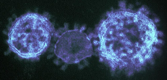 Вирус SARS-CoV-2 под электронным микроскопом