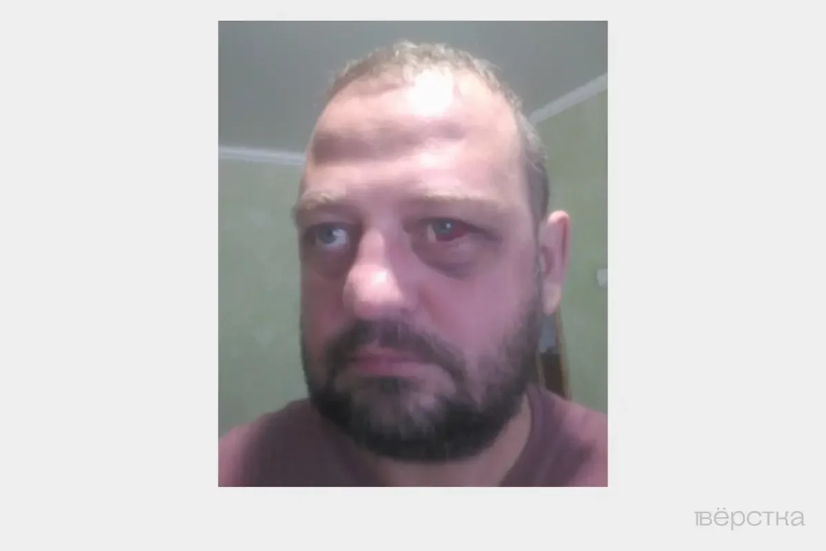 Селфи Валентина Харламова после побоев в полиции