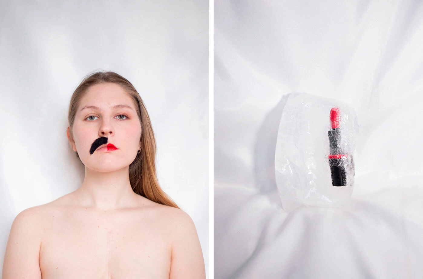 Случаи поликистоза яичников иногда остаются недиагностированными