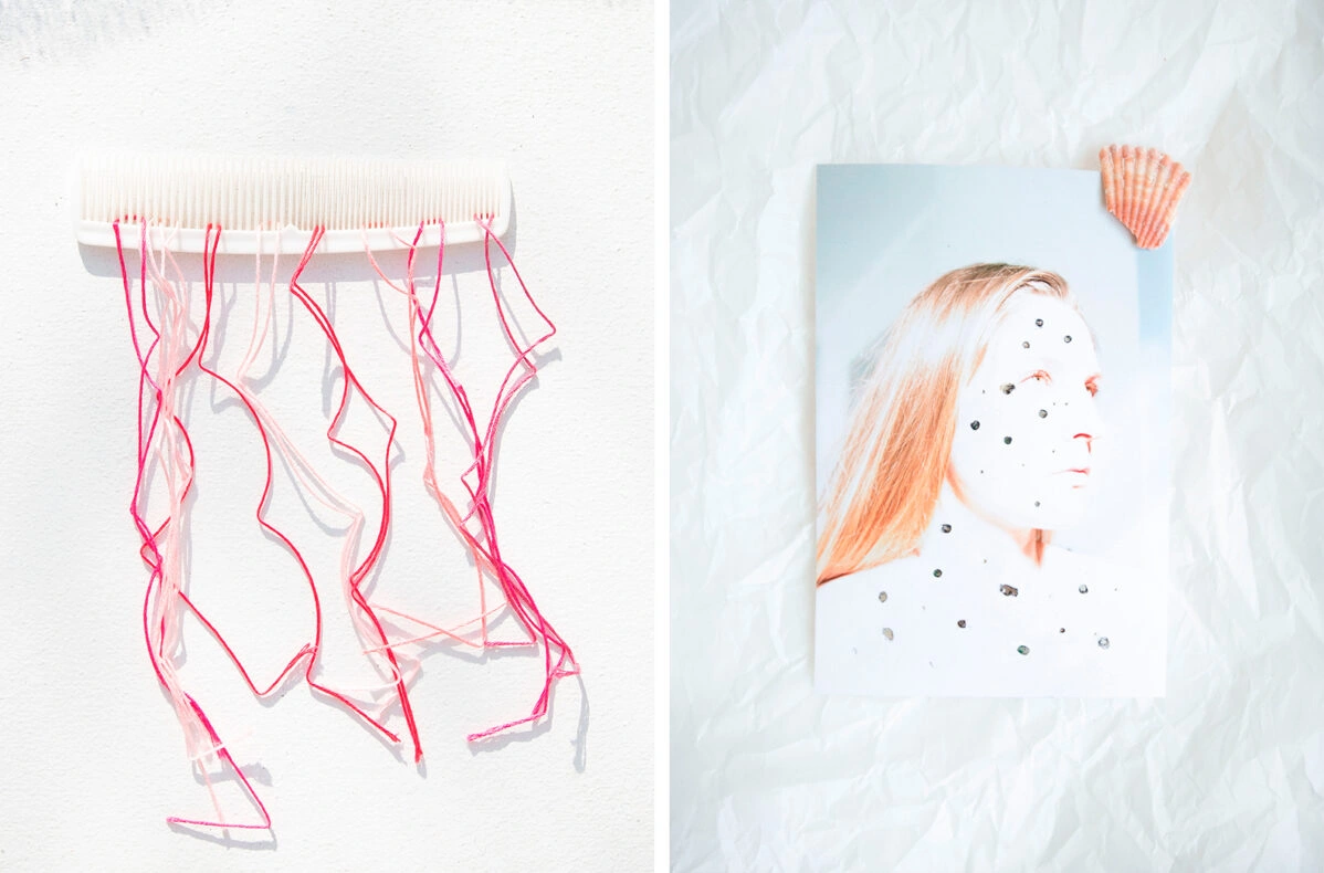 Женщинам с&nbsp;синдромом поликистоза яичников на&nbsp;протяжении всей жизни вновь и&nbsp;вновь приходится сталкиваться с&nbsp;акне