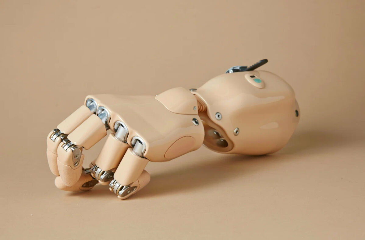 Протезы рук бывают косметическими и&nbsp;функциональными. Последние бывают: тяговыми и&nbsp;биоэлектрическими (бионическими)